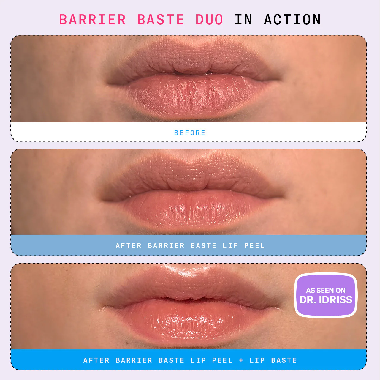 Barrier Baste Lip Baste - Image 7