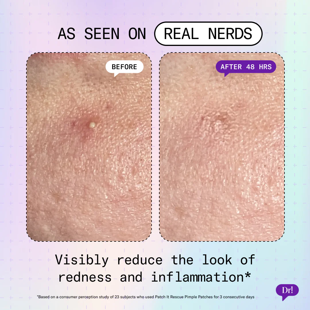Patch It Rescue Pimple Patches - Image 3