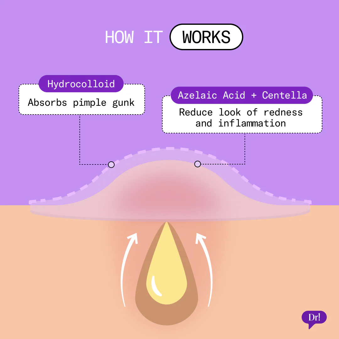 Patch It Rescue Pimple Patches - Image 6